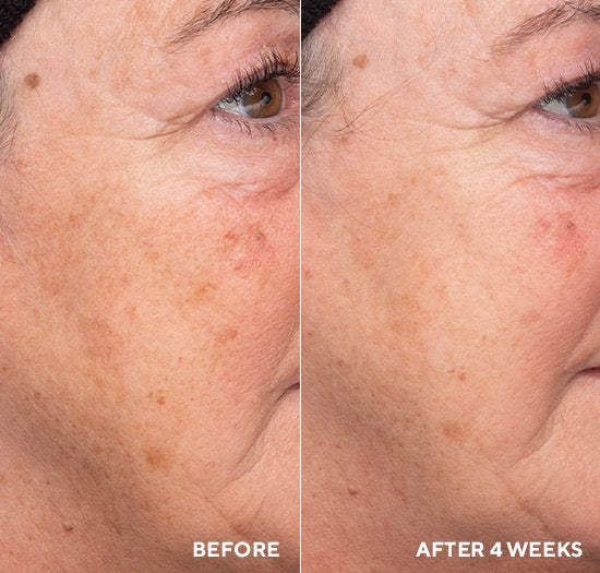 Liquid Resurfacing Solution – Щоденний незмивний лосьйон-ексфоліант 120 ml Hydropeptide