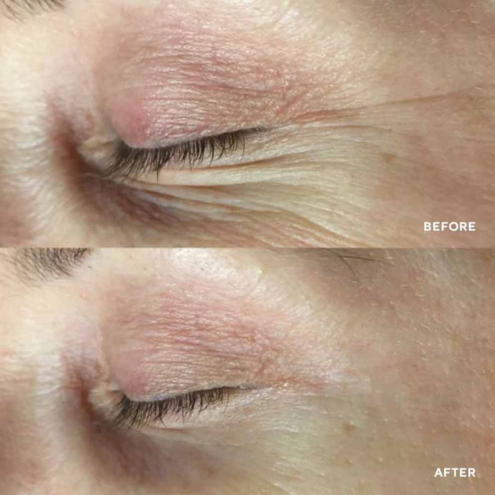 PolyPeptide collagel + mask for eyes Гідрогелева маска проти зморшок для зони навколо очей HydroPeptide 8 шт