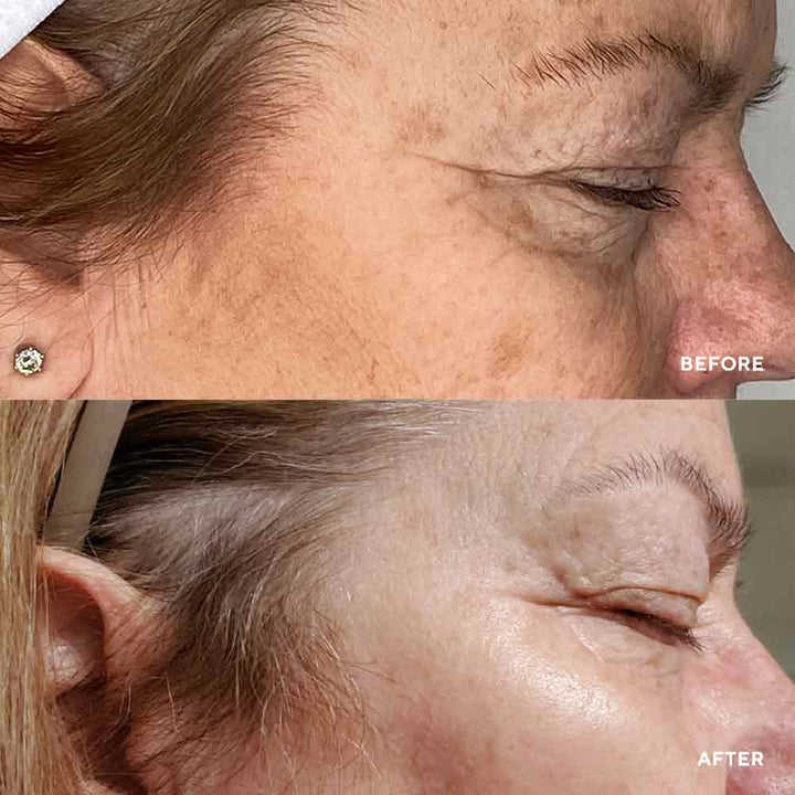 Vital Eyes Сироватка для зони навколо очей HydroPeptide 15 ml