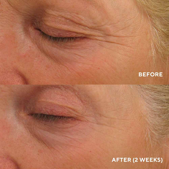 Eye Authority Крем для комплексного омолодження зони навколо очей HydroPeptide 15 ml