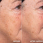Liquid Resurfacing Solution – Щоденний незмивний лосьйон-ексфоліант 120 ml Hydropeptide