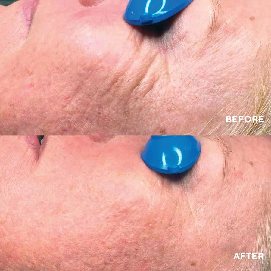 Nimni cream Запатентований колагеновий комплекс HydroPeptide  15  ml