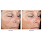 Активна система для домашнього догляду - Active Peel System iS Clinical