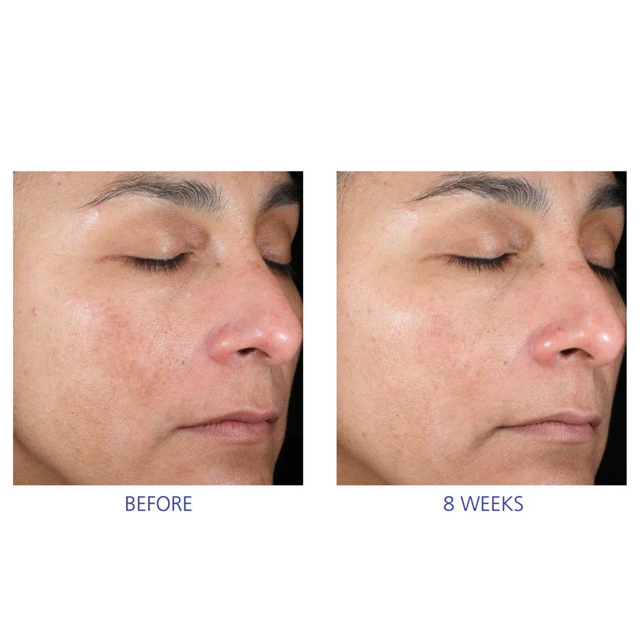 Активна система для домашнього догляду - Active Peel System iS Clinical