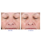 Активна система для домашнього догляду - Active Peel System iS Clinical