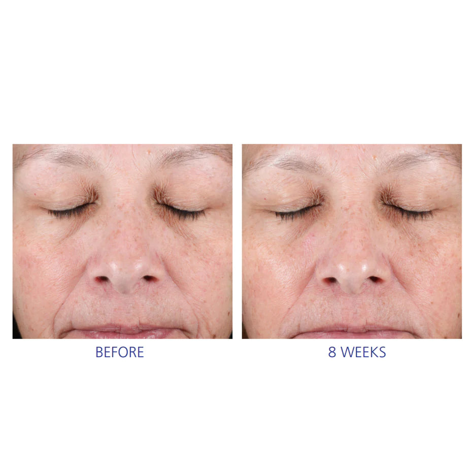 Активна система для домашнього догляду - Active Peel System iS Clinical