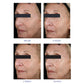 Крем для догляду за зоною навколо очей з ретинолом - Eye Complex iS Clinical  15  g